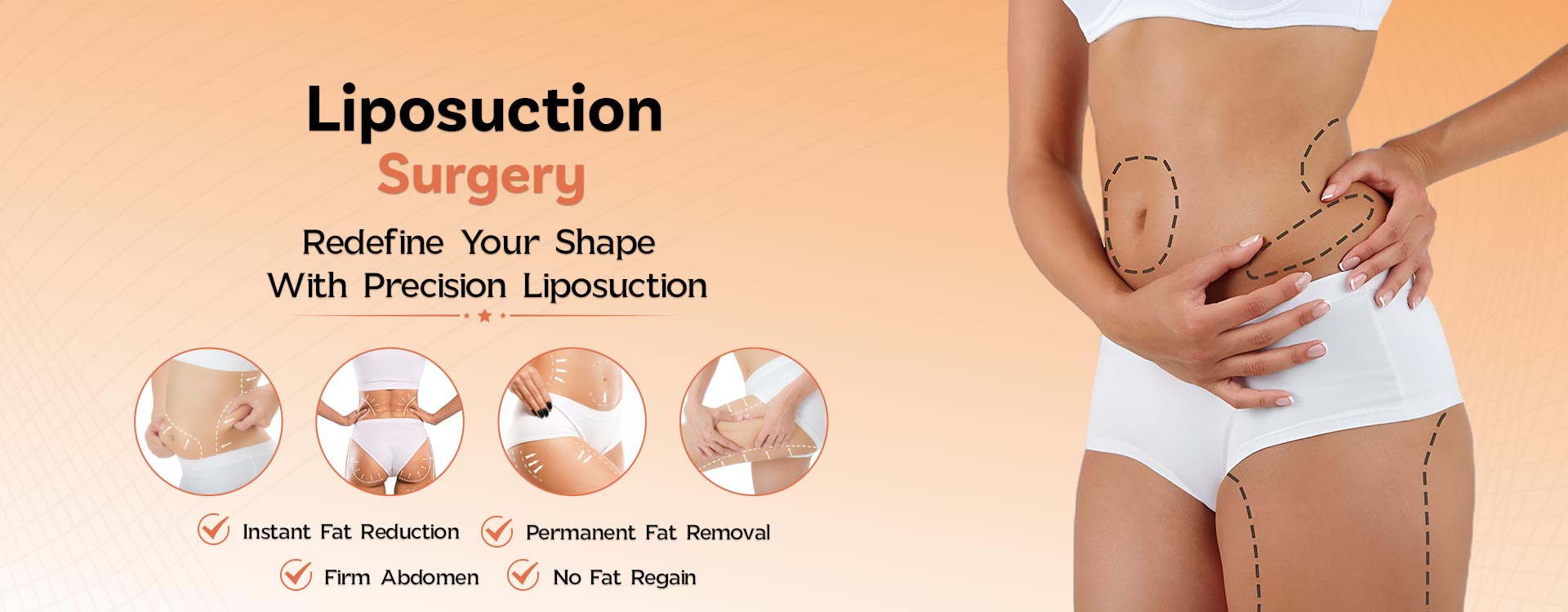 Liposuction Surgery in Ludhiana