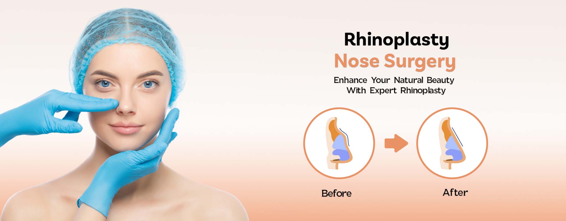 Rhinoplasty & Nose Surgery in Ludhiana