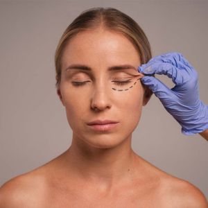 Blepharoplasty Surgery in Ludhiana