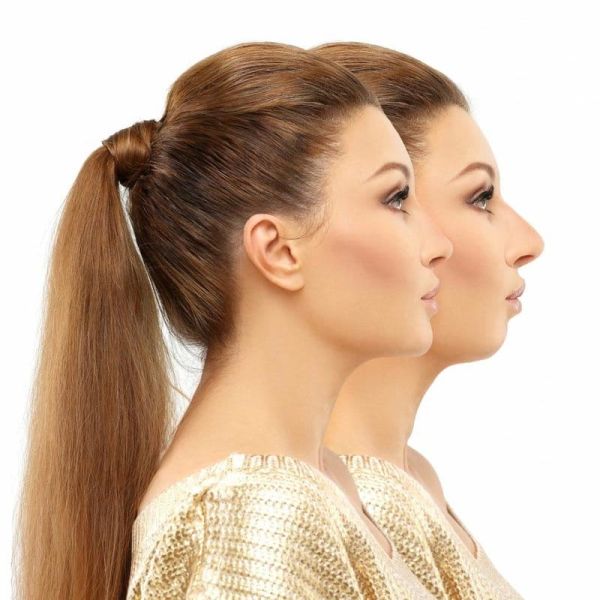 Best Chin Augmentation Surgeon in Ludhiana