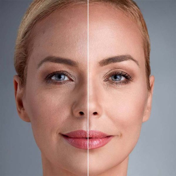 Facelift Surgery in Calgary