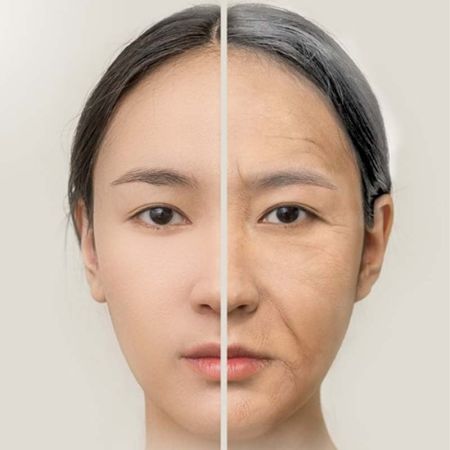 Facial Fat Grafting in Toronto